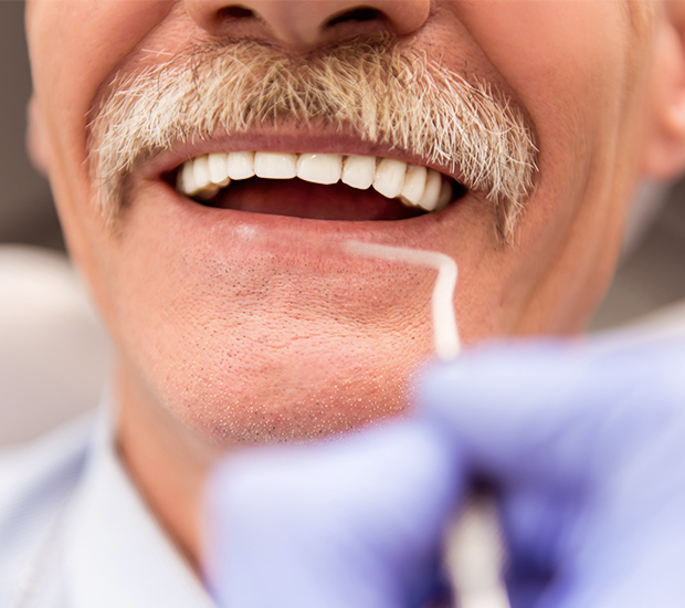 Bloomfield Adjusting to New Dentures