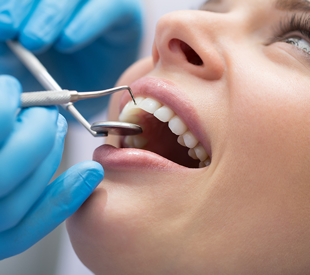 Bloomfield Dental Bonding