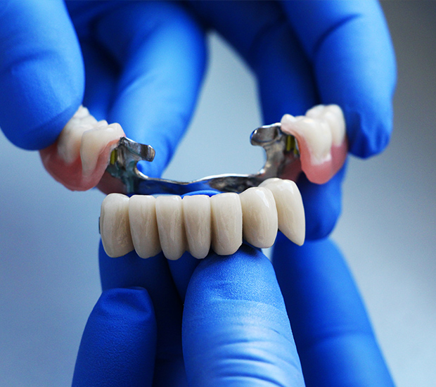Bloomfield Dental Bridges