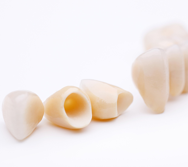 Bloomfield Dental Crowns and Dental Bridges