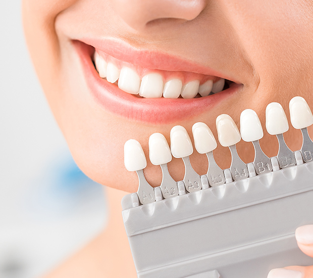 Bloomfield Dental Veneers and Dental Laminates