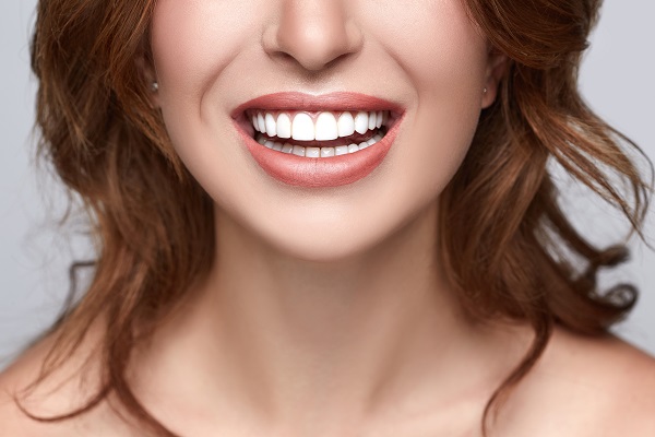 Smile Makeover Bloomfield, NJ