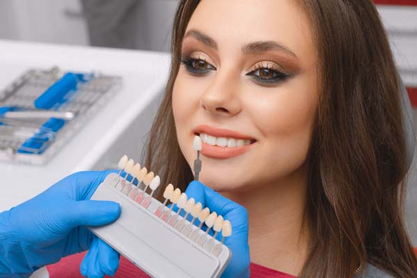 When Are Veneers Recommended?