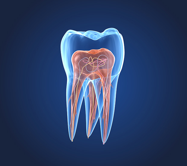 Bloomfield What is an Endodontist